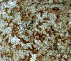 Arthonia rubella