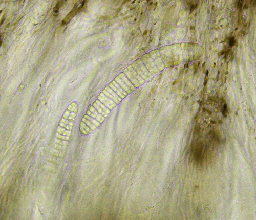 Calopadia floridana ascospores