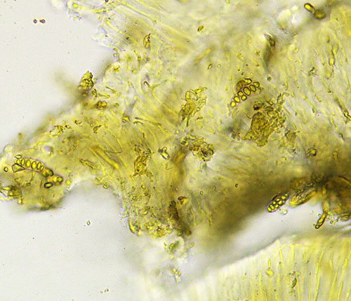 Leucodecton expallescens ascospores