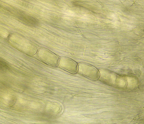 Monoblastia palmicola ascus
