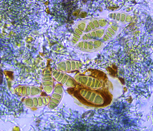  Stirtonia byssoidea ascospores