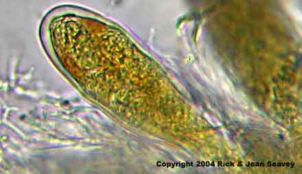Mycoporum acervatum stained ascus.