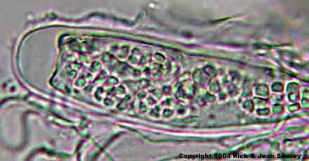 Mycoporum acervatum unstained ascus.