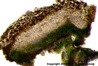 Caloplaca flavovirescens thin section.