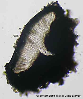 Gyrostomum scyphuliferum thin section.